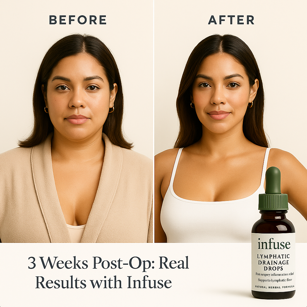 Lymphatic Drainage Drops (30 Servings)