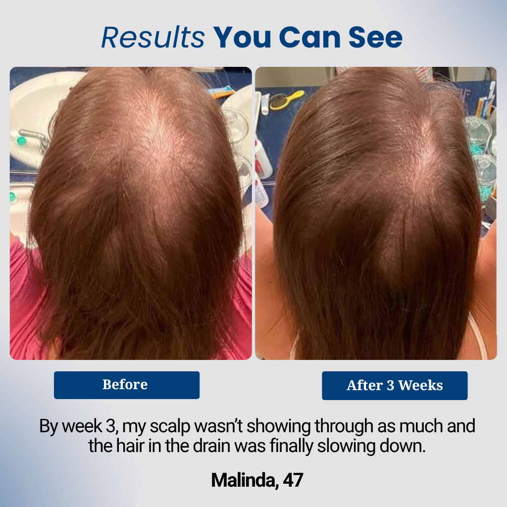 Collagen Peptides Protein+ Superblend