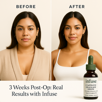 Lymphatic Drainage Drops (30 Servings)