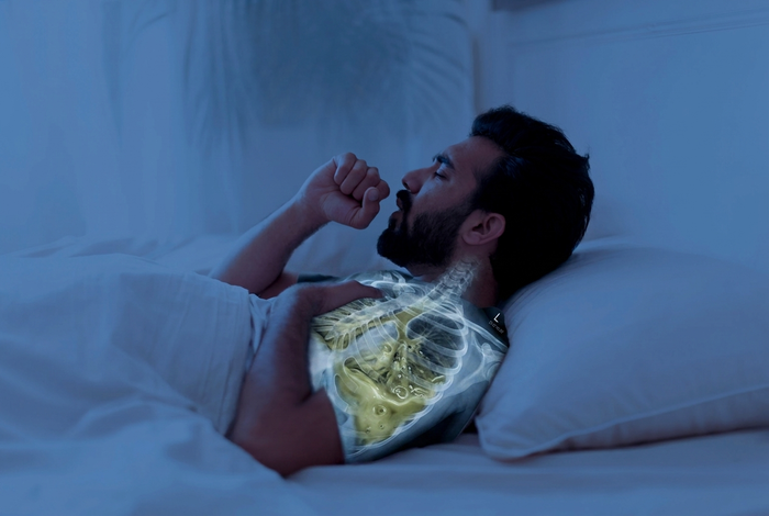 Nighttime acid reflux diagram showing gravity and esophageal exposure